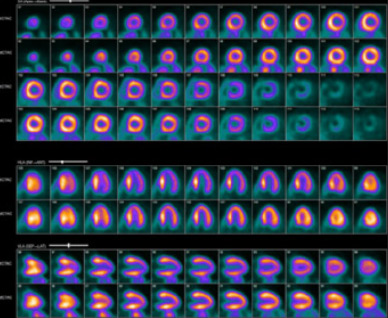 Corridor 4DM SPECT images in a PACS