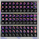 PACS Cloud access to SPECT medical images