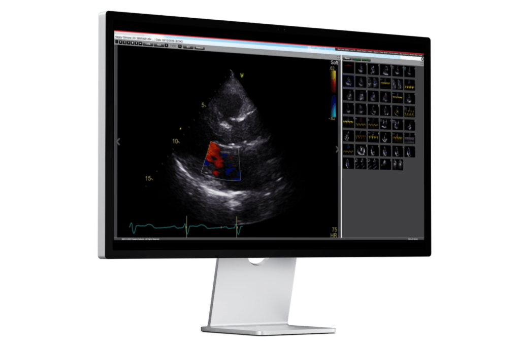 Multimodality Viewer