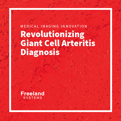 Revolutionizing Giant Cell Arteritis Diagnosis: The Power of Advanced Imaging