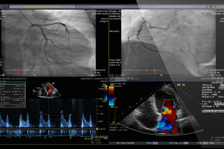 multimodality medical imaging - Enhance cardiology workflows with high-resolution imaging, structured reporting, and advanced diagnostic tools on a unified platform.