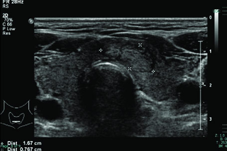 Multimodality Medical Imaging - Supercharge your ultrasound workflow with AccessPoint's digital powerhouse! Store images in the cloud, access them from anywhere, and watch your devices play nice with seamless interoperability.