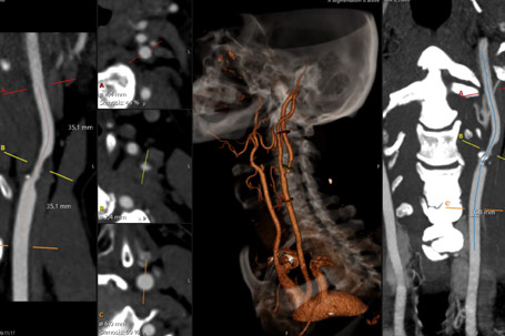 Multimodality Medical Imaging - Level-up your vascular lab with AccessPoint's powerhouse PACS!