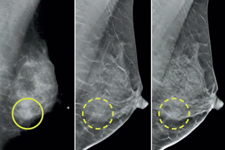 Multimodality Medical Imaging - Amplify your OB/GYN practice with AccessPoint's cutting-edge cloud PACS! Seamlessly blend ultrasound, MRI, and 3D mammography into one streamlined workflow.