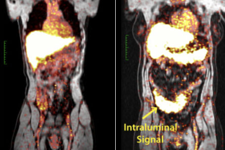 Multimodality Medical Imaging - Elevate your nuclear medicine game with AccessPoint's cloud-powered platform! Seamlessly integrate PET, SPECT, and hybrid imaging for advanced post-processing and razor-sharp diagnostics.