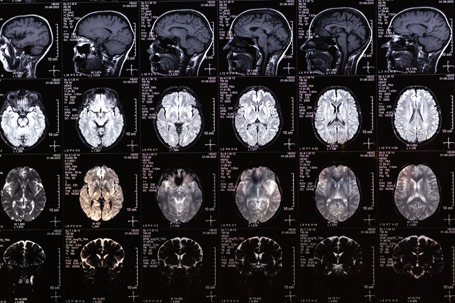 Multimodality Medical Imaging - Bring your imaging arsenal together with AccessPoint's all-in-one cloud platform!