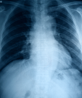 Enhanced X-ray image with improved clarity using clinical imaging software